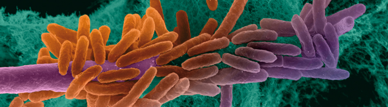 Interaction Aspergillus fumigatus et Pseudomonas aeruginosa, deux microorganismes du microbiote pulmonaire, observÈe en microscopie Èlectronique ‡ balayage